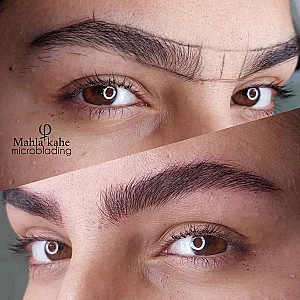 مرکز تخصصی میکروبلیدینگ ابرو مهلا کاهه