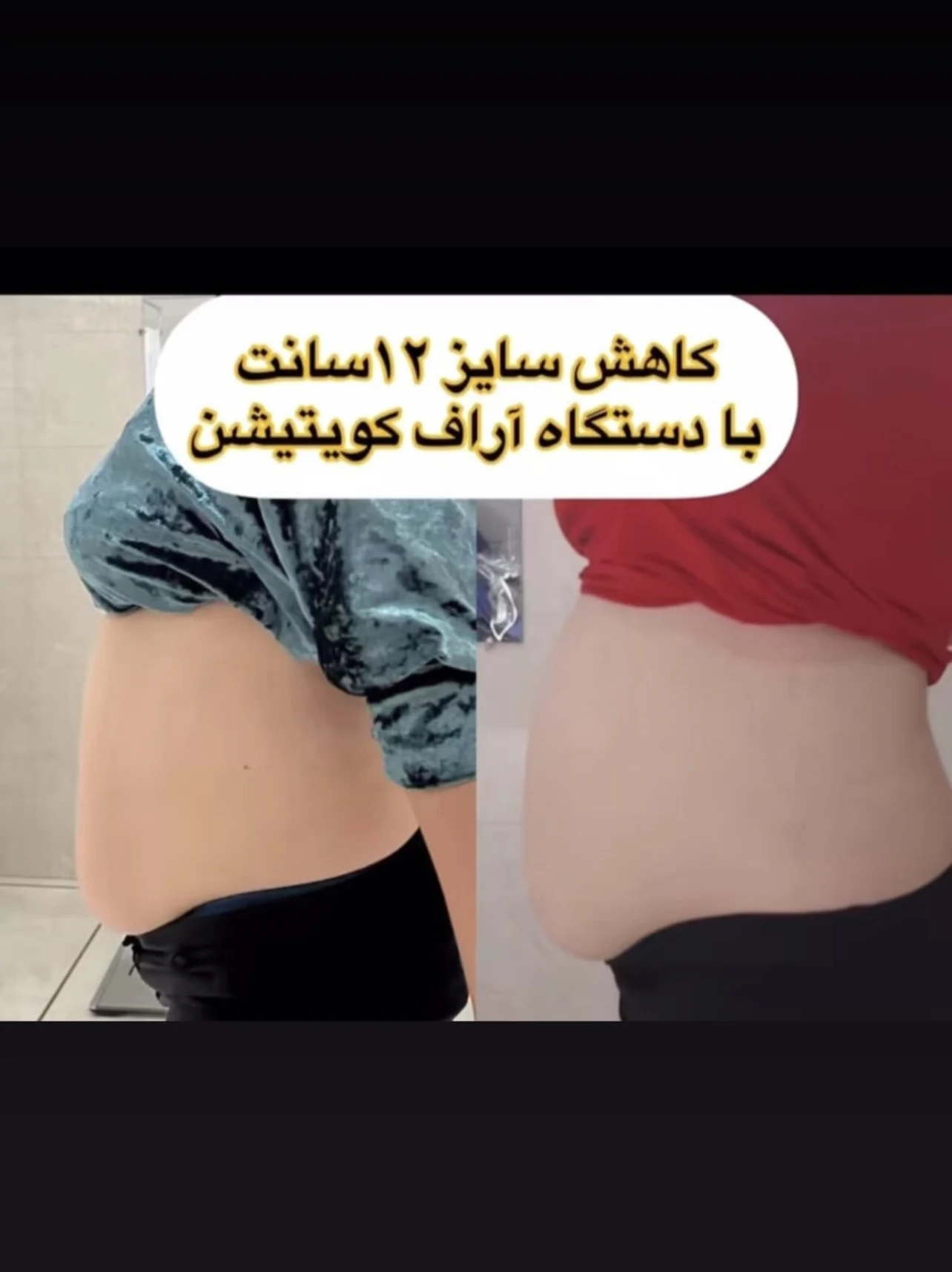 مشاور تغذیه و رژیم درمانی حنانه بهشتی - تصویر 2