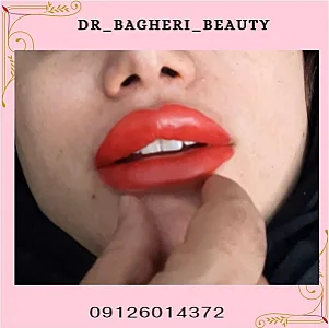 مرکز لیزر و ژل لب روسی دکتر فاطمه آقاباقری