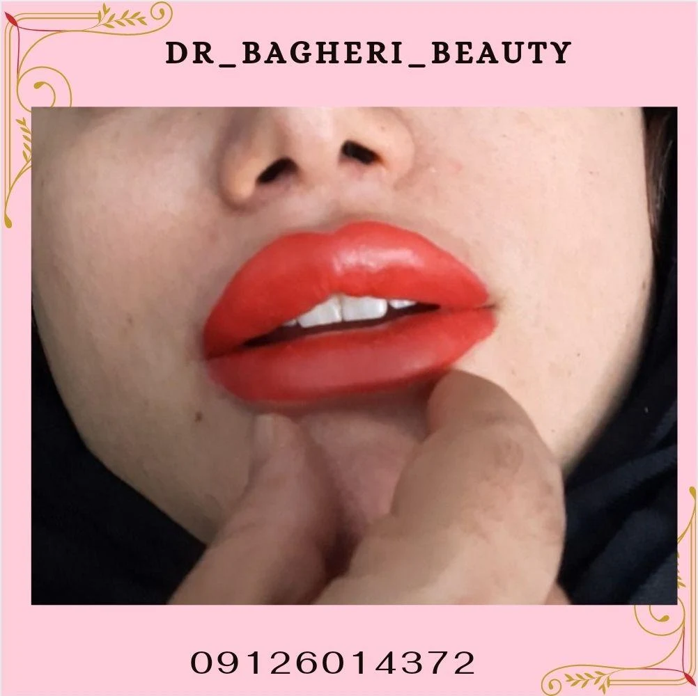 مرکز لیزر و ژل لب روسی دکتر فاطمه آقاباقری