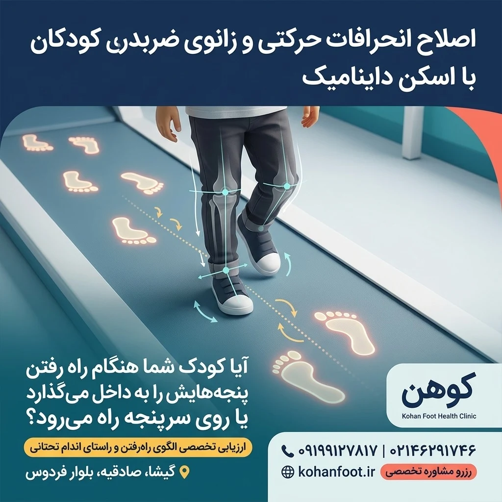 کلینیک کهن پا | اسکن پا و کفی طبی غرب تهران - تصویر 4