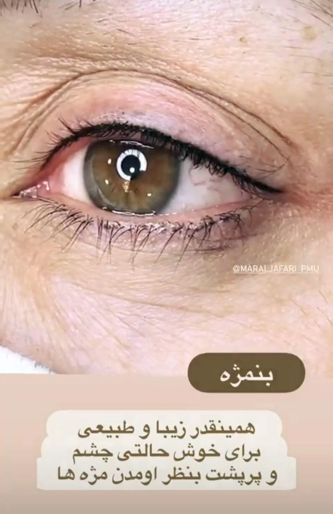 پیگمنتر(تتو صورت، ریموو تخصصی )