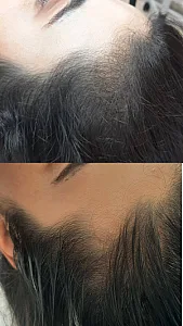 فیشال و پاکسازی پوست مرضیه صالحی