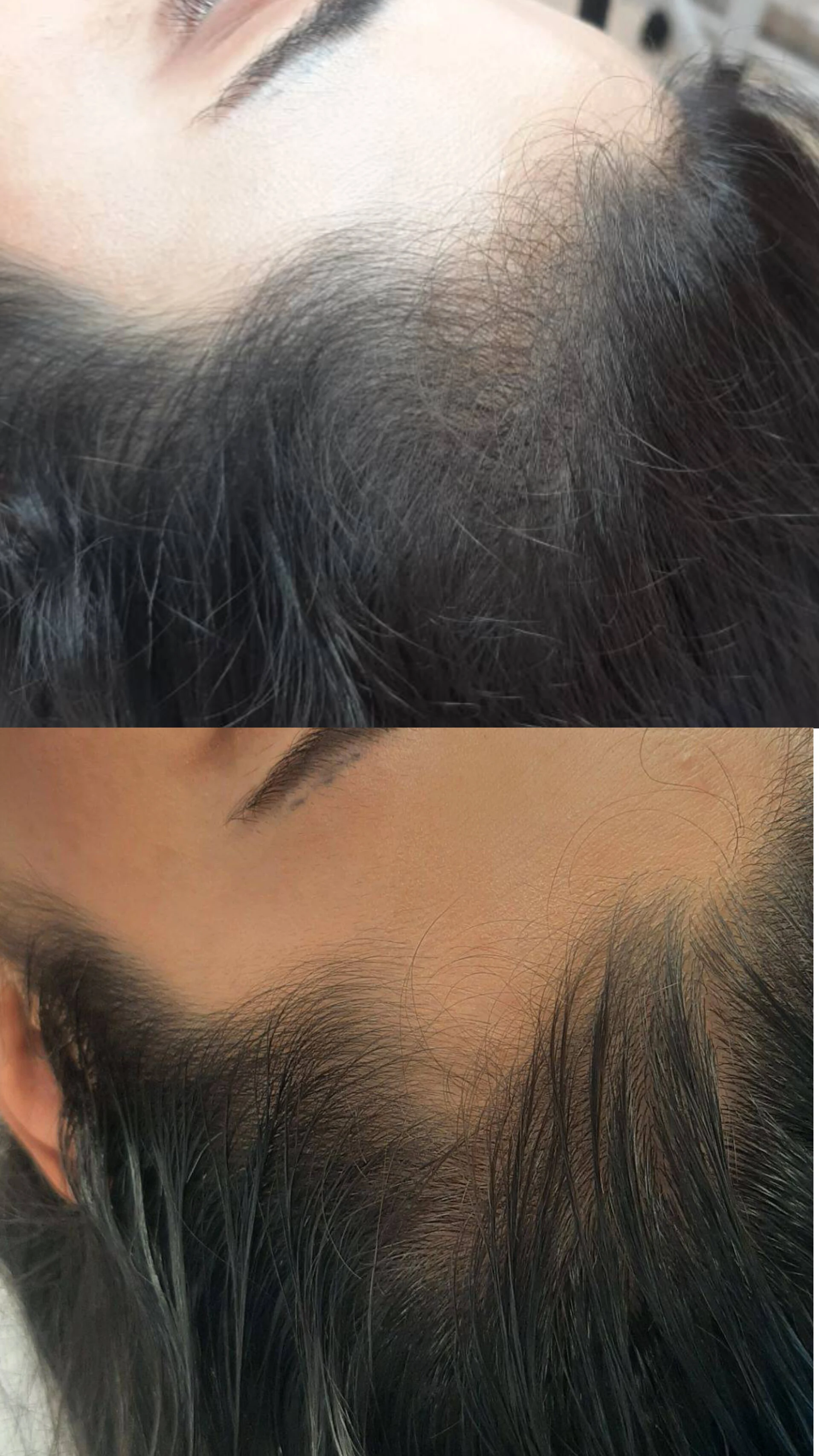 فیشال و پاکسازی پوست مرضیه صالحی - آموزشگاه آرایشگری در سنندج