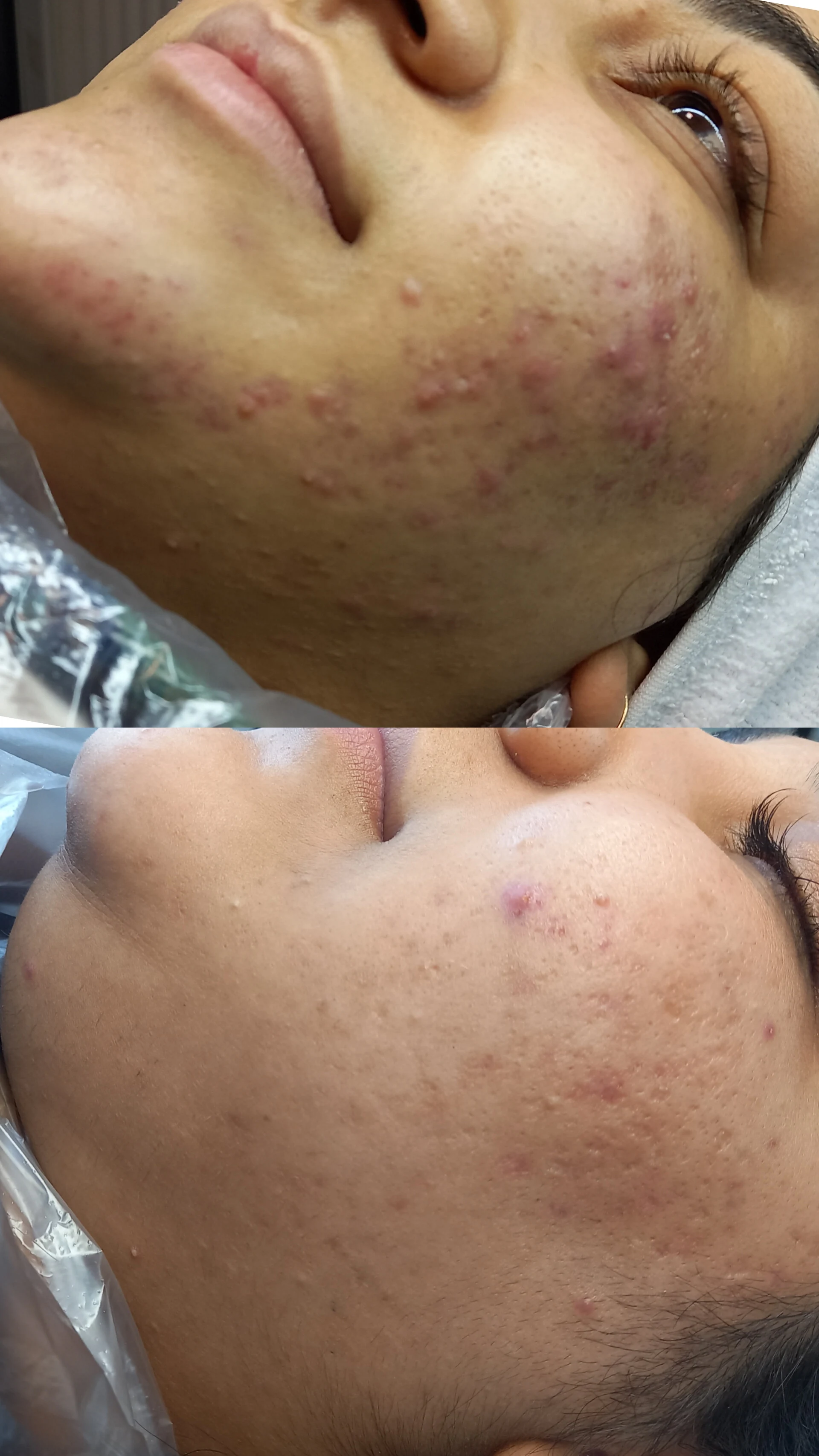 فیشال و پاکسازی پوست مرضیه صالحی - آموزشگاه آرایشگری در سنندج - تصویر 3