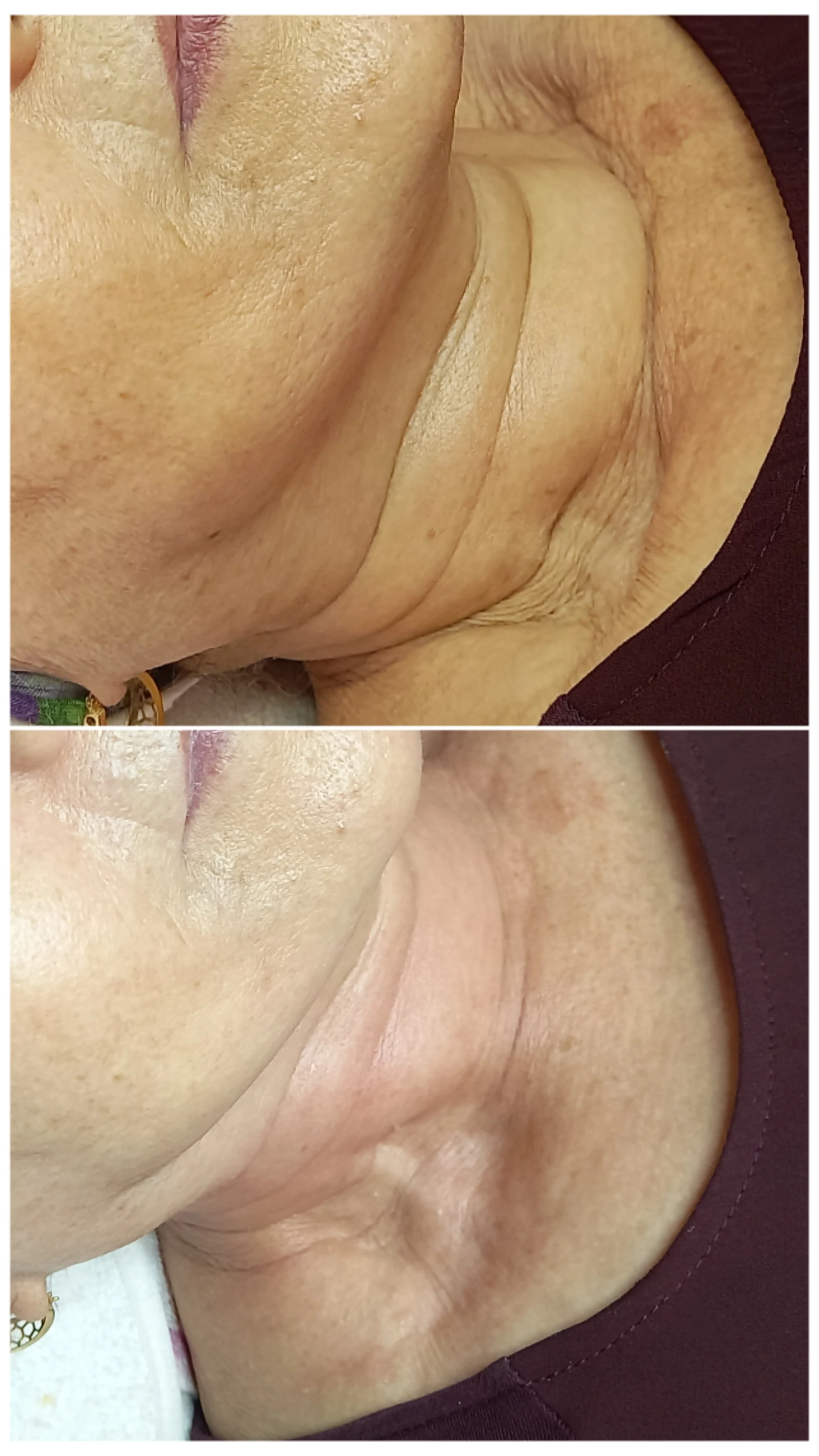 فیشال و پاکسازی پوست مرضیه صالحی - آموزشگاه آرایشگری در سنندج - تصویر 5
