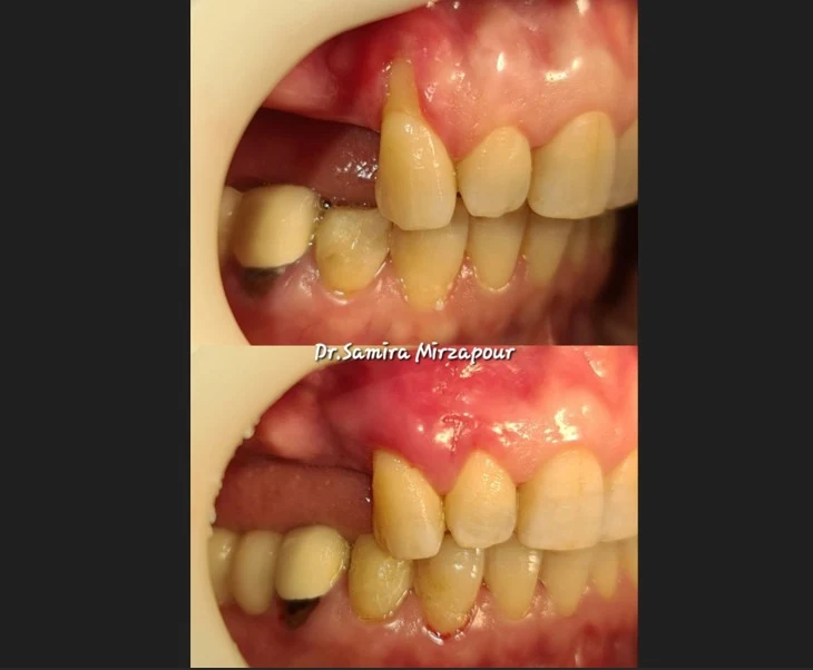 متخصص لثه و ایمپلنت تبریز دکتر سمیرا محمد میرزاپور