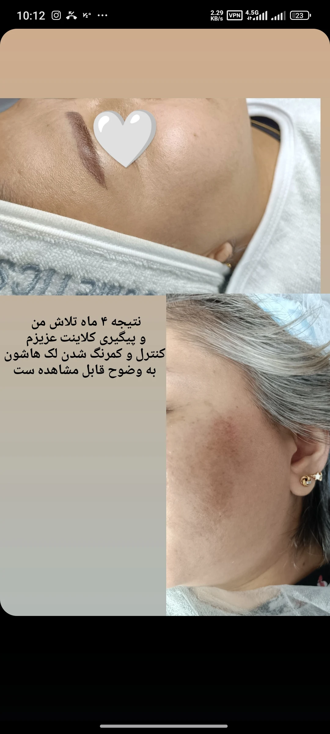 فیشال بویه - تصویر 3