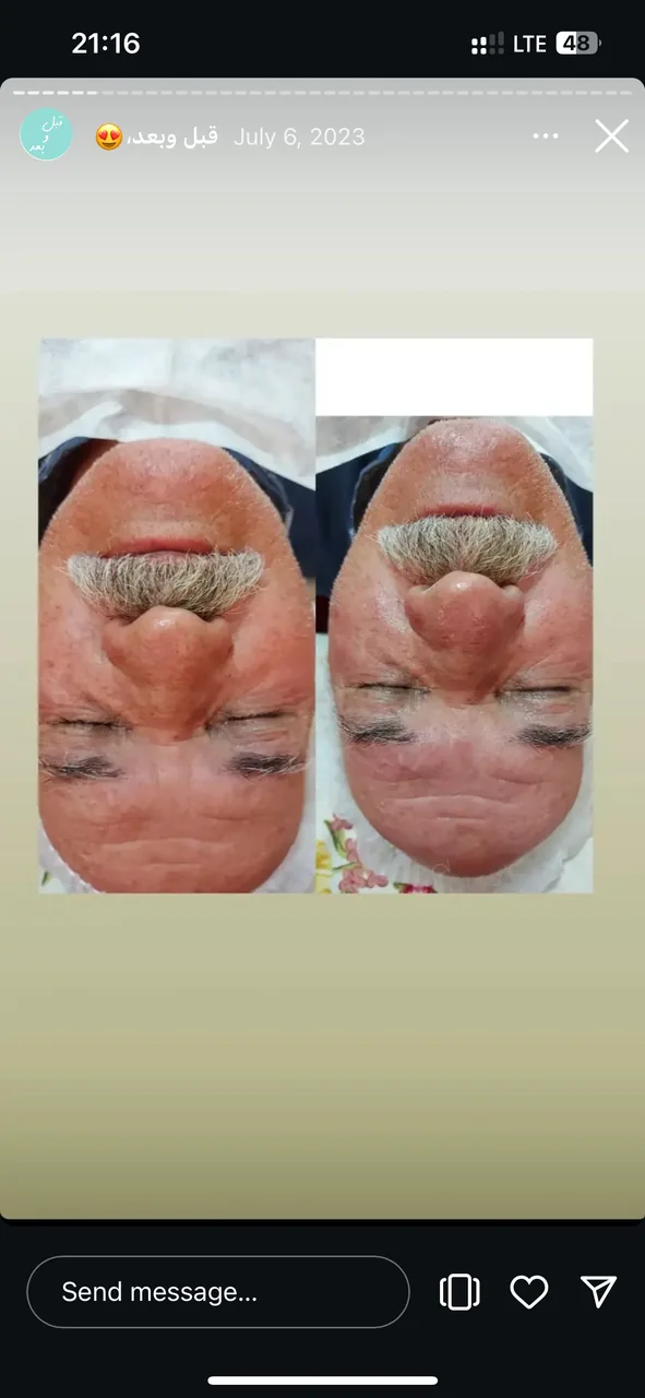 خدمات تخصصی پوست و مو مریم نصیرپور - تصویر 2