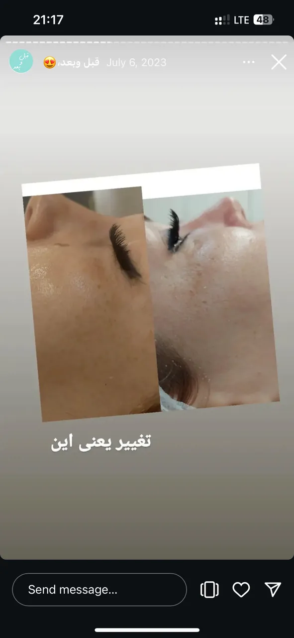 خدمات تخصصی پوست و مو مریم نصیرپور - تصویر 4