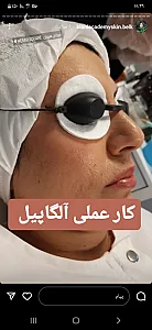 خدمات حرفه ای جوانسازی،و پاکسازی پوست