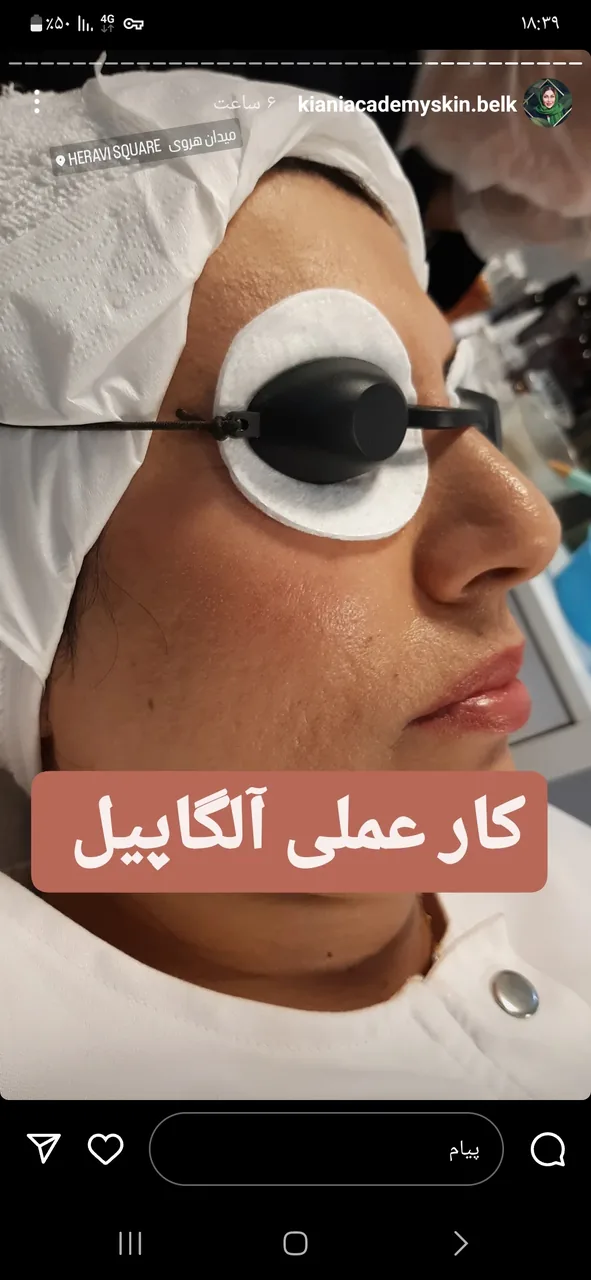 خدمات حرفه ای جوانسازی،و پاکسازی پوست
