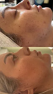خدمات تخصصی پوست و فیشال سندی