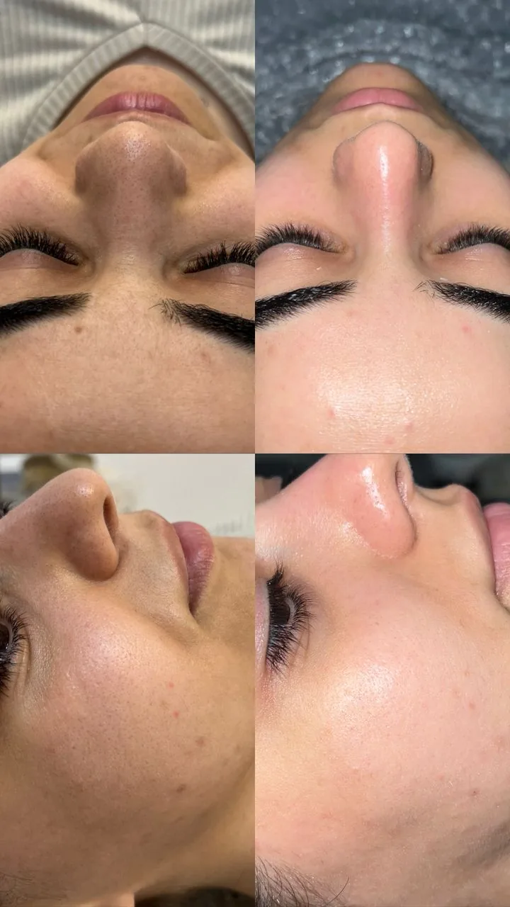خدمات تخصصی پاکسازی پوست ساجده عنایتی - تصویر 2