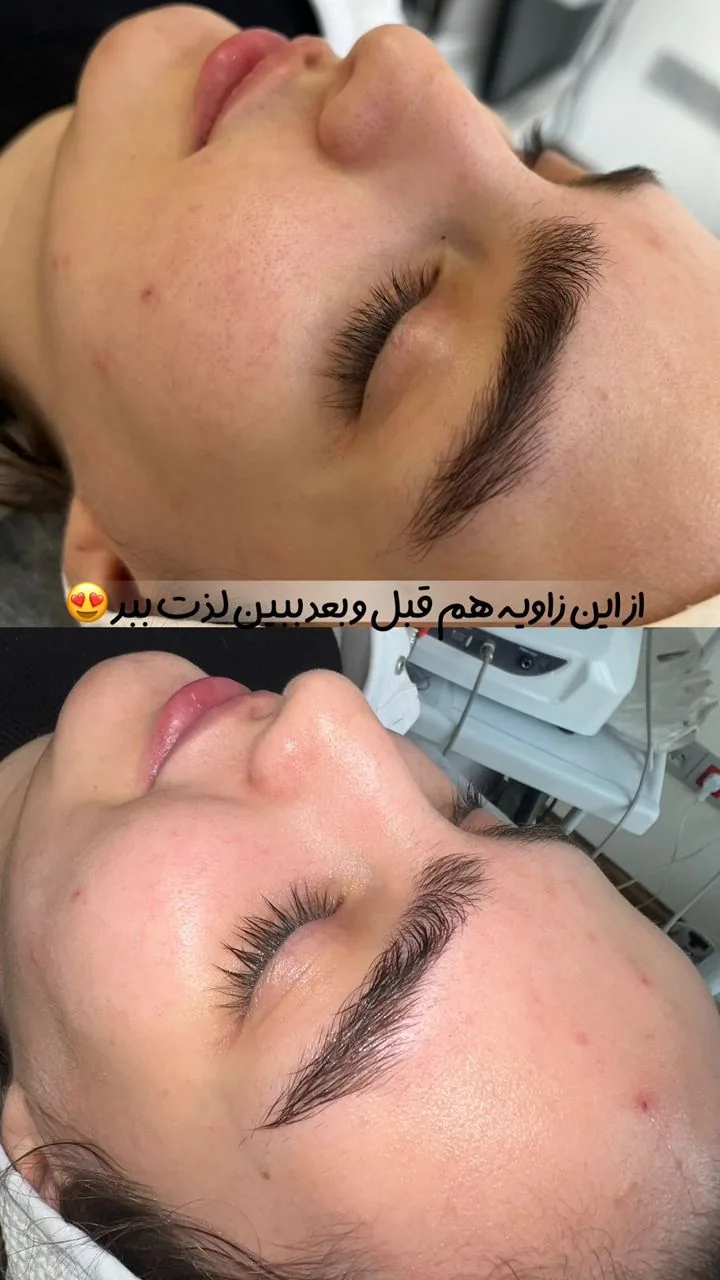 خدمات تخصصی پاکسازی پوست ساجده عنایتی - تصویر 3