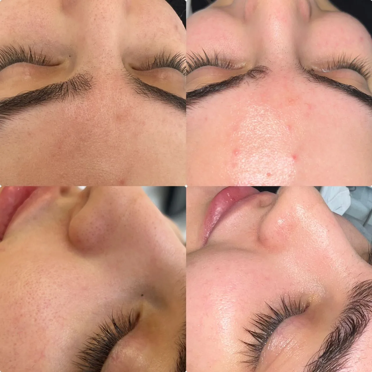 خدمات تخصصی پاکسازی پوست ساجده عنایتی - تصویر 4