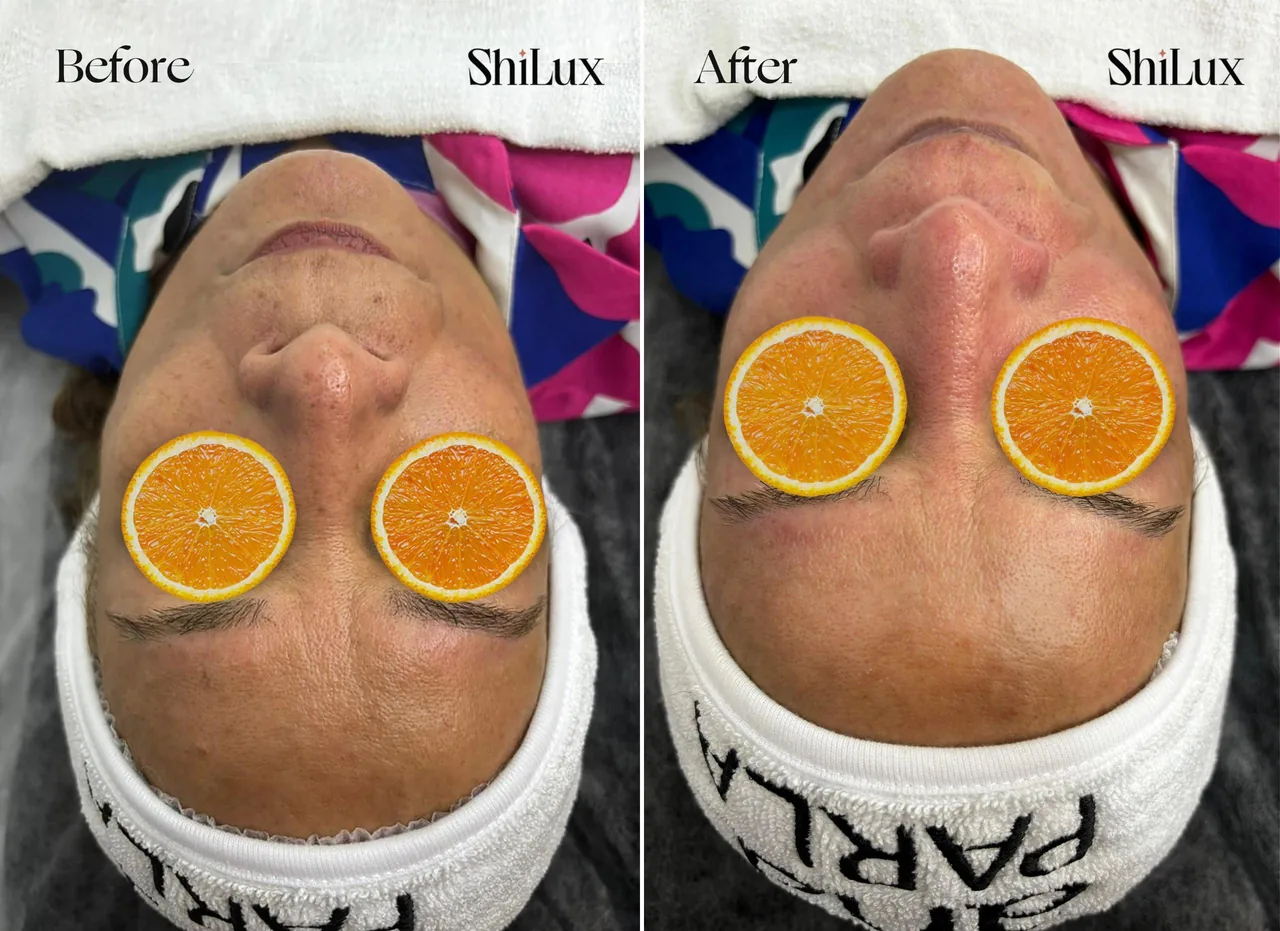 خدمات تخصصی پاکسازی پوست و فیشال شیلوکس - تصویر 3