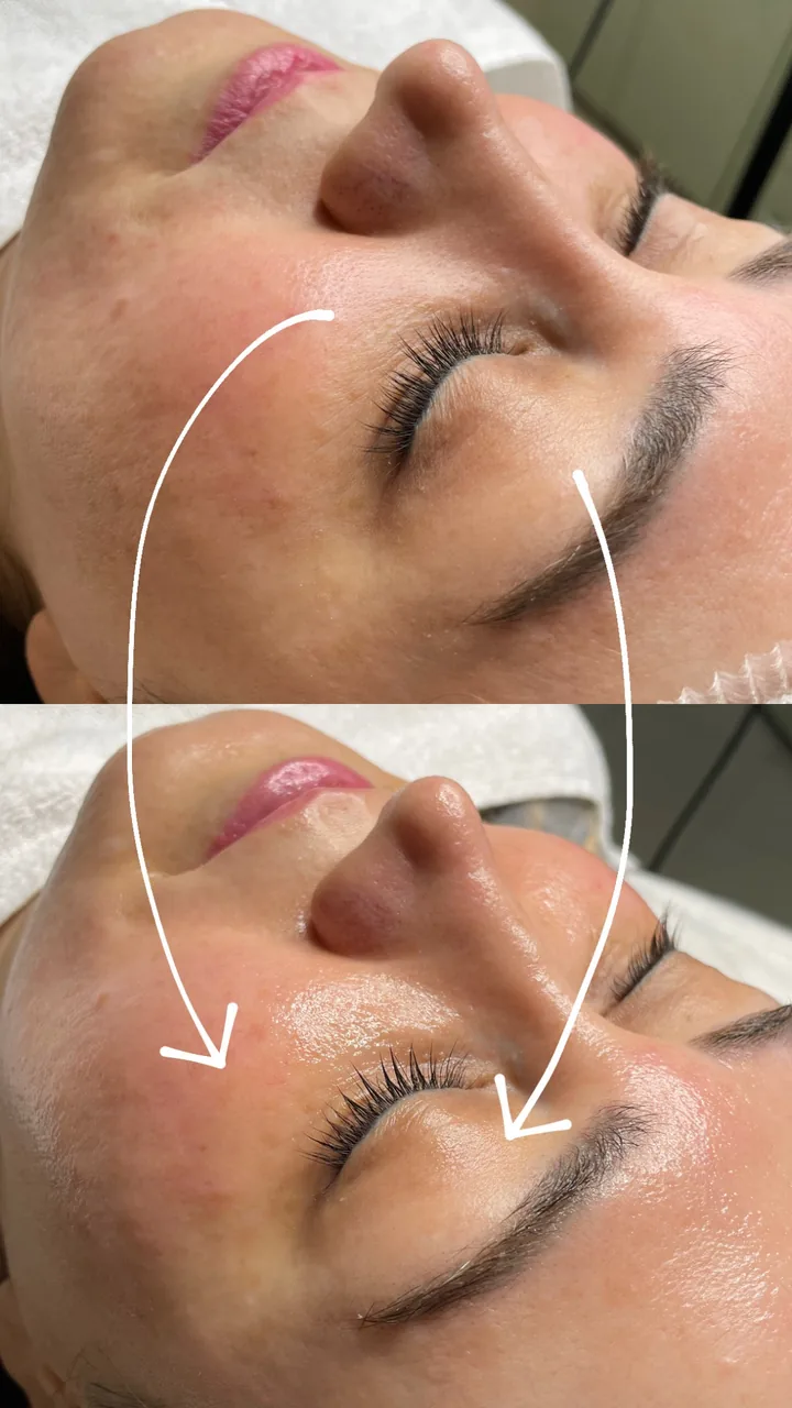 خدمات پاکسازی پوست و فیشال آرمی - تصویر 3