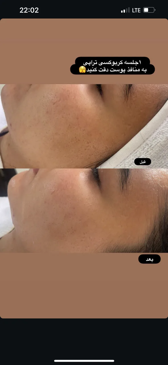 خدمات فیشال صورت و بدن طلوع - تصویر 3