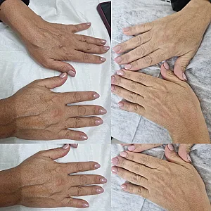 خدمات تخصصی پاکسازی پوست رویال اسکین
