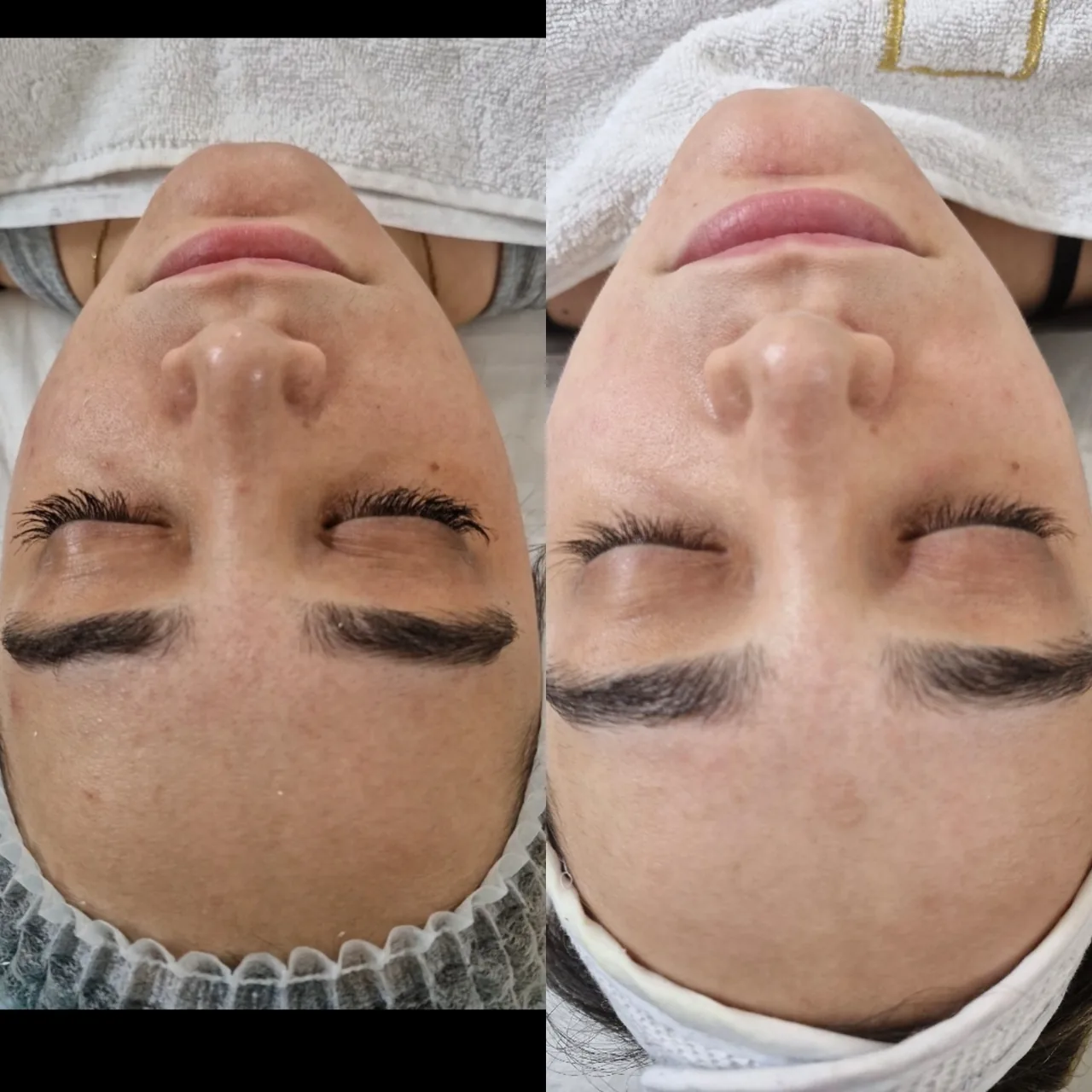 خدمات تخصصی پاکسازی پوست رویال اسکین - تصویر 2