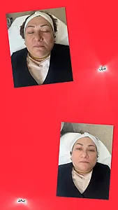 خدمات تخصصی پوست  غریبانی (بل اسکین کر)