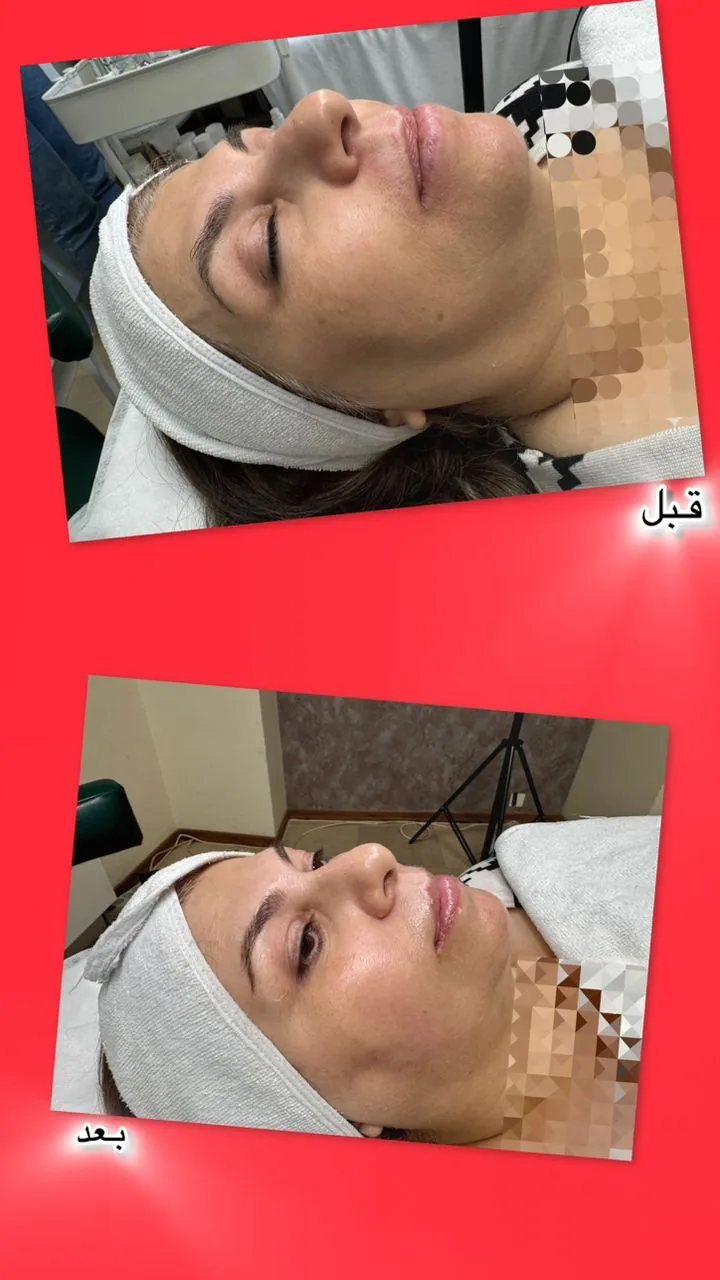 خدمات تخصصی پوست  غریبانی (بل اسکین کر) - تصویر 3