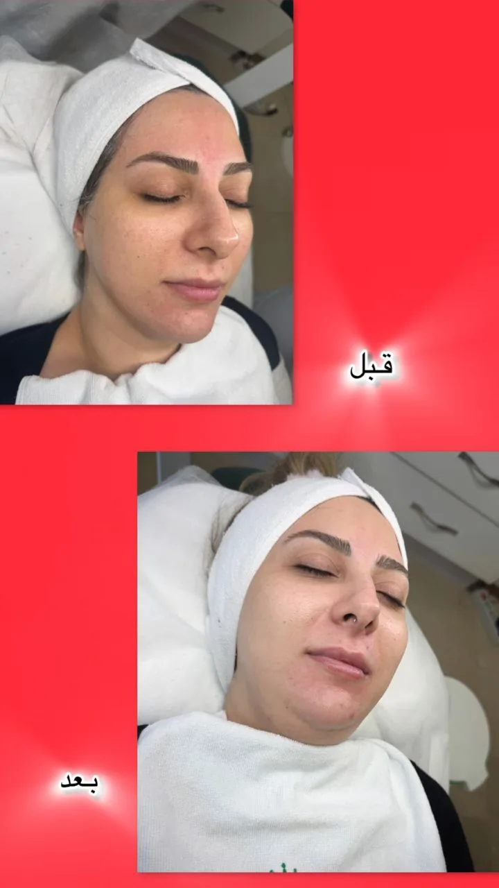 خدمات تخصصی پوست  غریبانی (بل اسکین کر) - تصویر 4