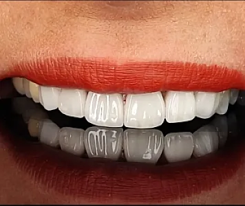 خدمات دندانپزشکی دکتر زهرا خلیلی