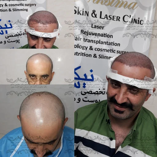 کلینیک کاشت مو وپوست و لیزر نیک سیما