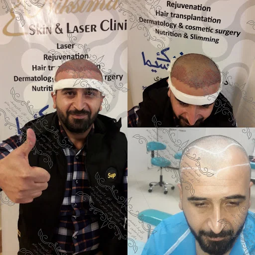 کلینیک کاشت مو وپوست و لیزر نیک سیما