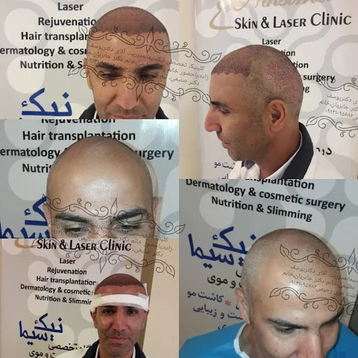 کلینیک کاشت مو وپوست و لیزر نیک سیما