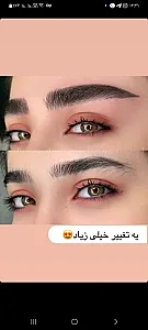 ریموو تخصصی و فیبروز ابرو، بن مژه، شیدینگ لب