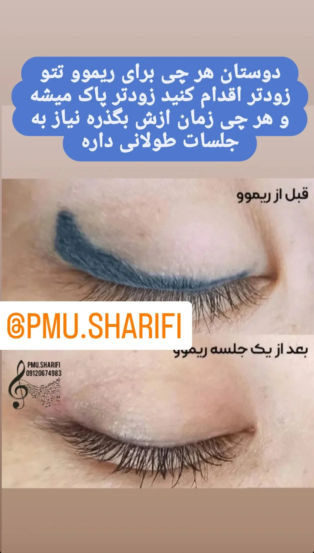 ریموو تخصصی و فیبروز ابرو، بن مژه، شیدینگ لب - آرایشگاه زنانه در قم - تصویر 7