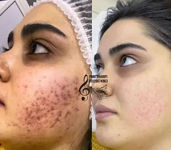 فیشال درمانی و پاکسازی تخصصی قم