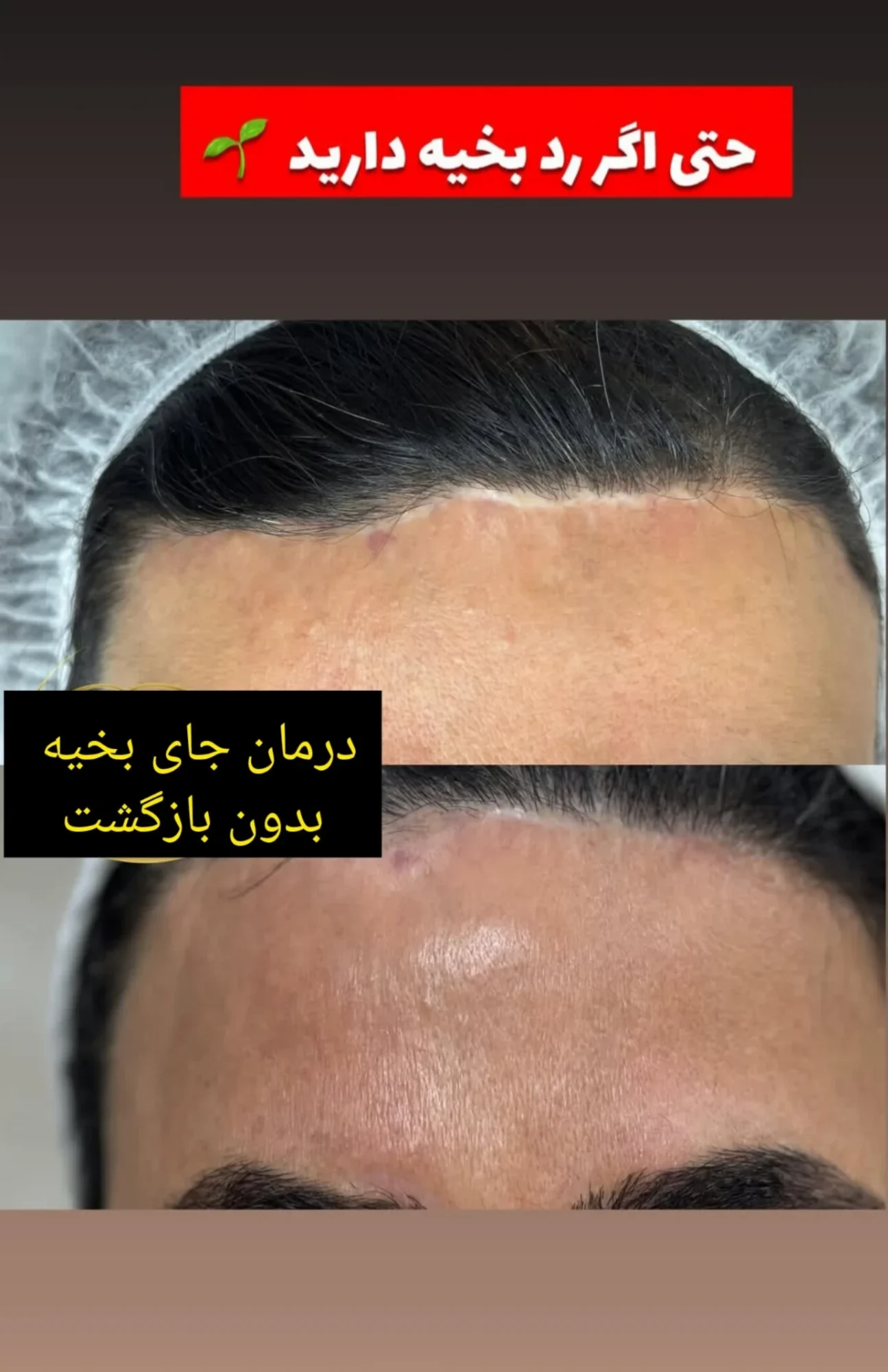 فیشال درمانی و پاکسازی تخصصی قم - کلینیک پوست و زیبایی در قم - تصویر 7