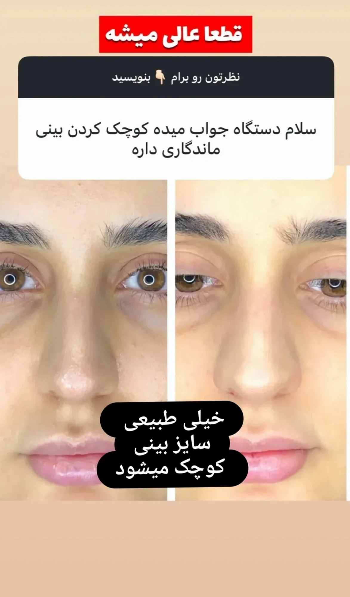فیشال درمانی و پاکسازی تخصصی قم - کلینیک پوست و زیبایی در قم - تصویر 8