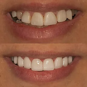 متخصص ایمپلنت و پروتزهای دندانی دکتر میرشکار