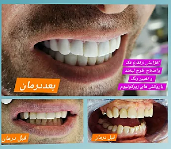 دندانپزشکی وایمپلنت  دکتر مهردادافتحی
