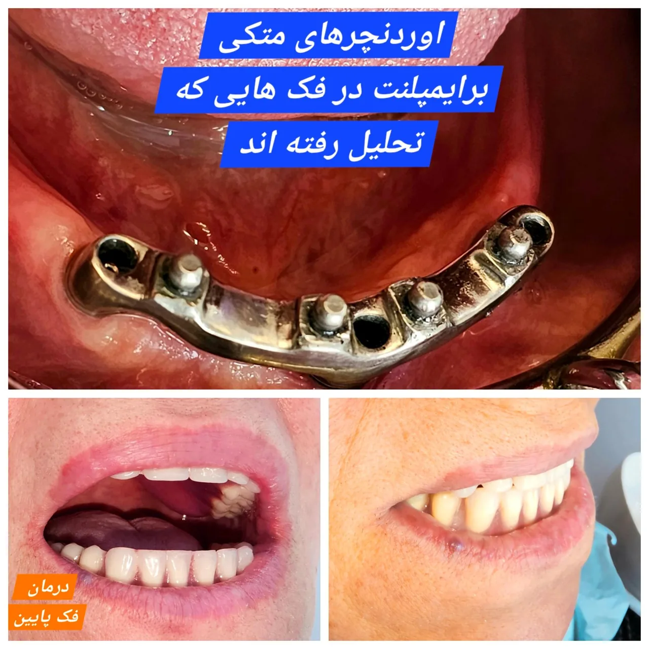 دندانپزشکی وایمپلنت  دکتر مهردادافتحی - تصویر 2