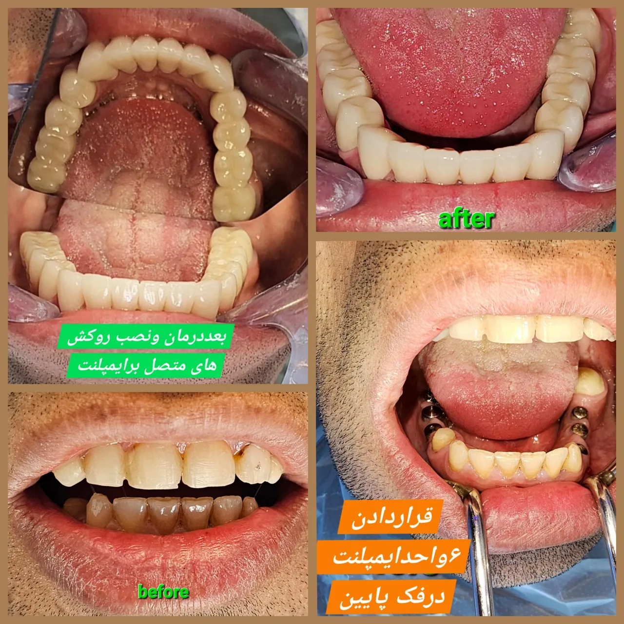 دندانپزشکی وایمپلنت  دکتر مهردادافتحی - تصویر 3