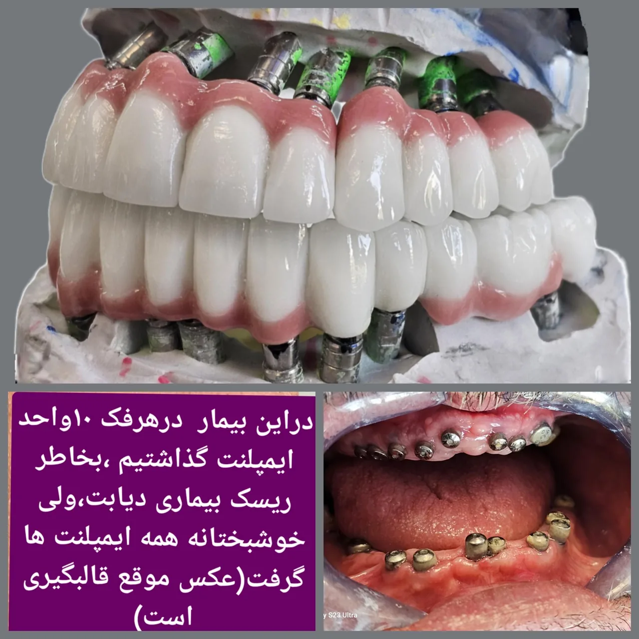 دندانپزشکی وایمپلنت  دکتر مهردادافتحی - تصویر 4
