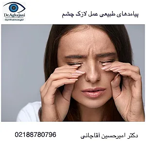 دکتر آقاجانی متخصص چشم