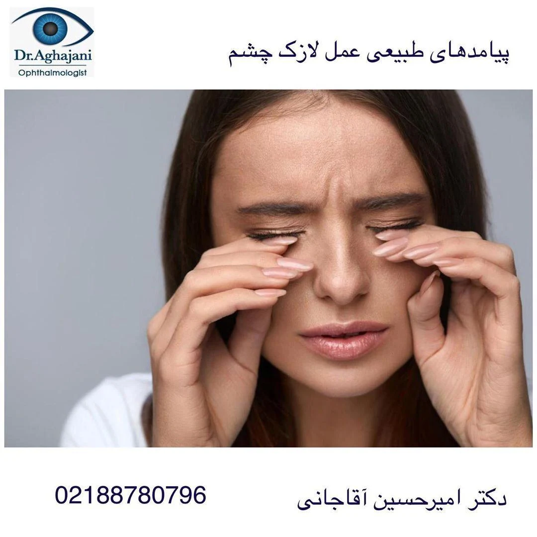 دکتر آقاجانی متخصص چشم