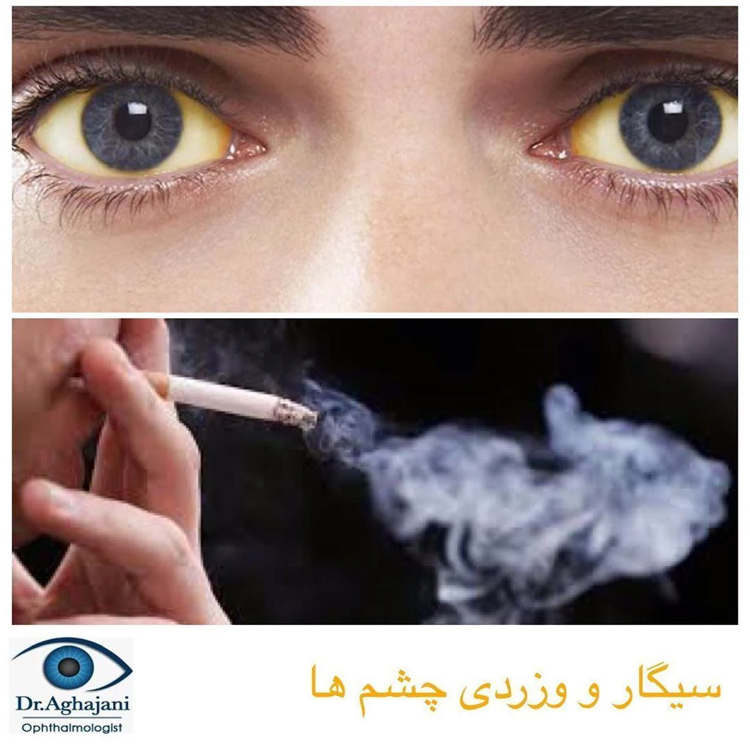 دکتر آقاجانی متخصص چشم - تصویر 3
