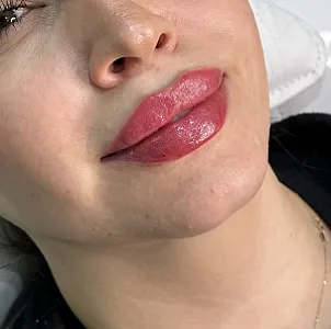 مطب پوست و مو  دکتر شعله زکی خانی