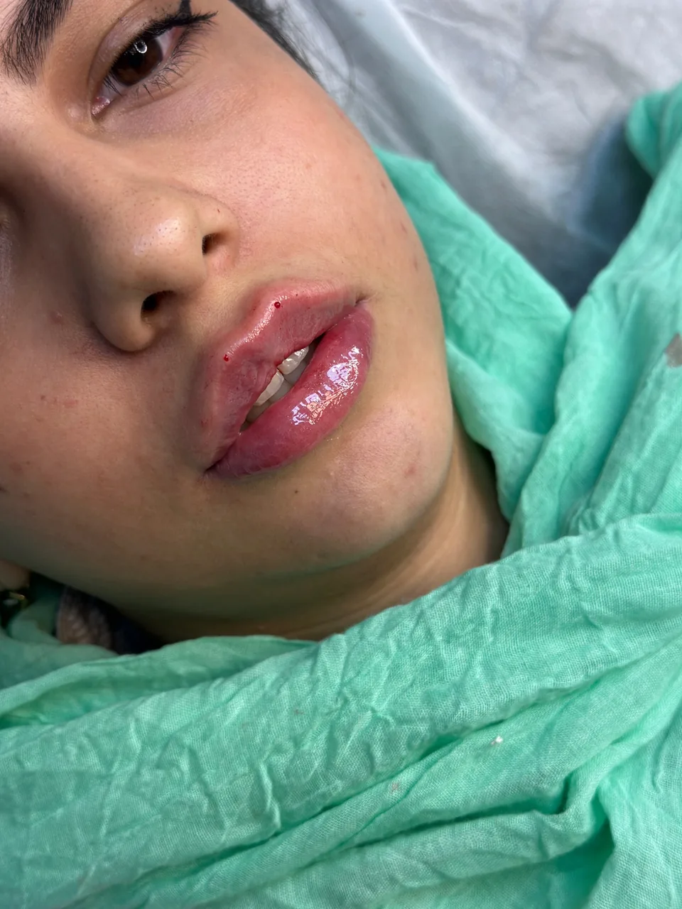 مطب پوست و مو  دکتر شعله زکی خانی - تصویر 3