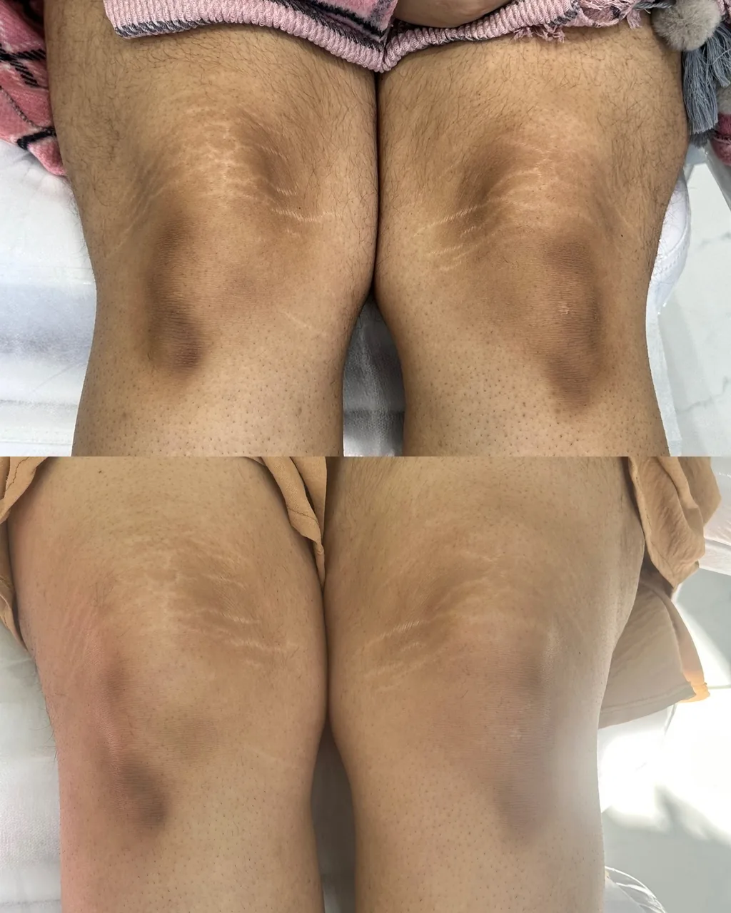 مطب پوست و مو  دکتر شعله زکی خانی - تصویر 4