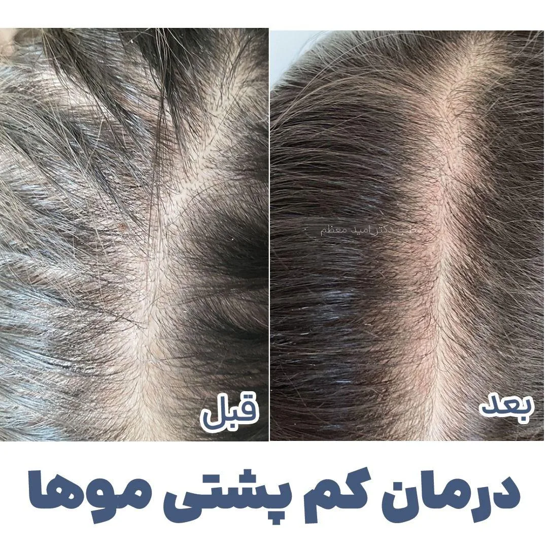 کلینیک زیبایی دکتر محمدجواد امیدمعظم - تصویر 3