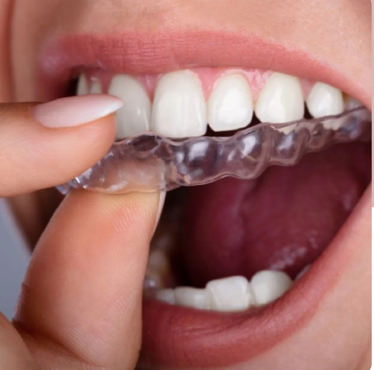 مطب دندان پزشکی دکتر مرتضوی - تصویر 3